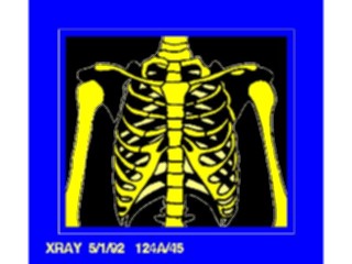 Sticker Custom Preview Image #068949 Health Medical Miscellaneous Xray